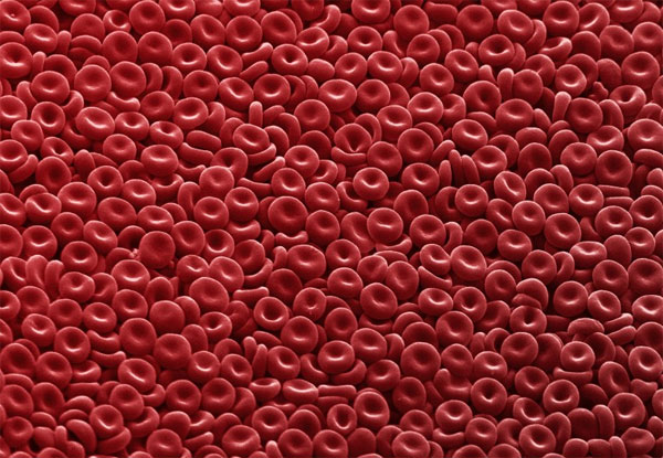 Picture 1 of Invented super blood immunity to dioxins