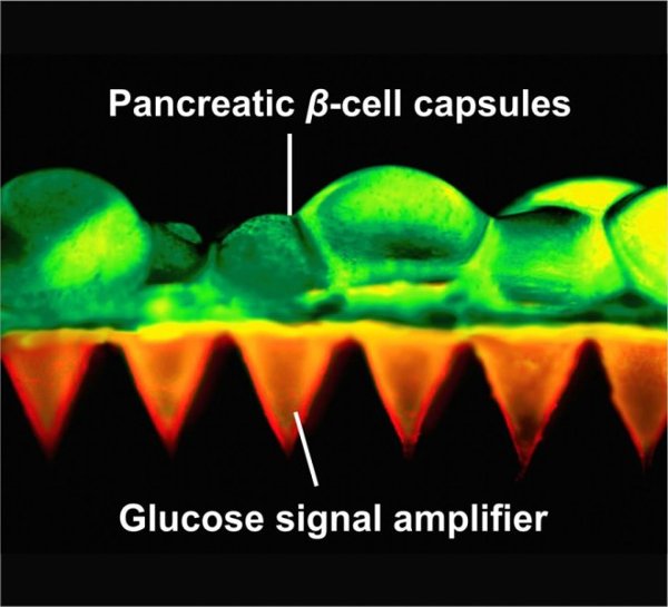 Picture 4 of Invention helps people with diabetes do not need to pay attention to regular insulin injections