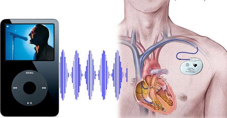 Picture 1 of IPods change the heart rate