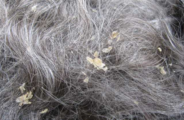 Picture 3 of Is it a piece of dry scalp?