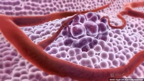 Picture 2 of Is there any disease in the world called 'Heart cancer'?