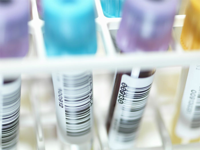 Picture 1 of Israel found a protein that reduced 97% of HIV virus after 8 days