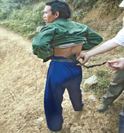 Picture 2 of It is difficult to explain who grows abnormal tails