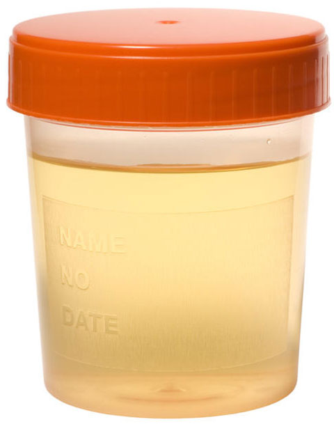 Picture 1 of It is easy to isolate stem cells in the urine
