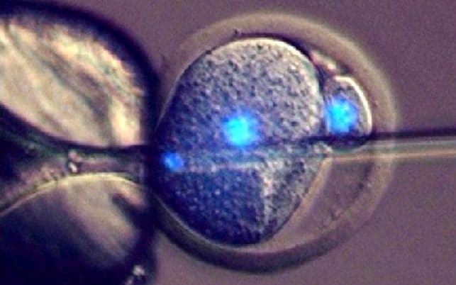 Picture 1 of It is possible to give birth without a mother's egg
