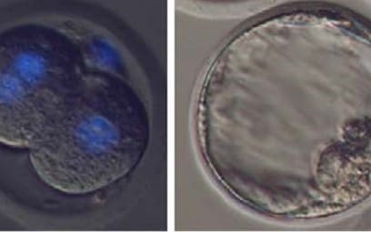 Picture 4 of It is possible to give birth without a mother's egg