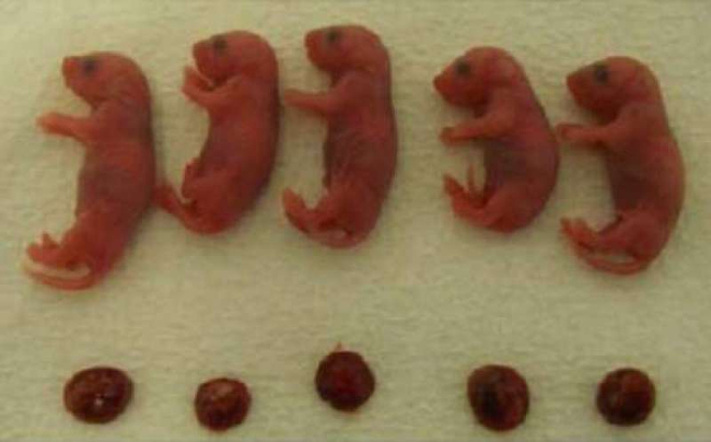 Picture 7 of It is possible to give birth without a mother's egg