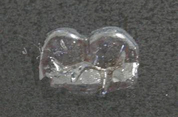 Picture 1 of Japan creates permanent anti-decay patch