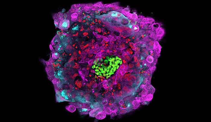 Picture 2 of Kissing can infect the virus causing infertility?