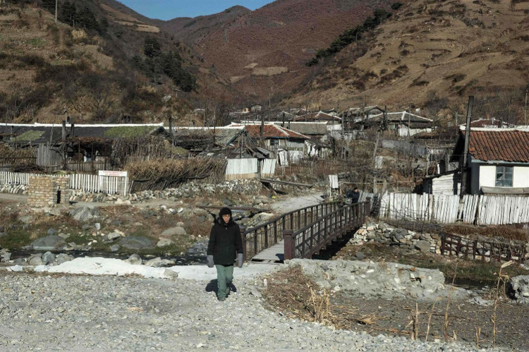 Picture 1 of Koreans got strange diseases after missile tests