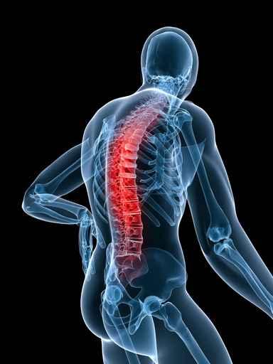 Picture 1 of Lack of high levels of vitamin D can result in Parkinson's