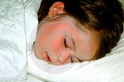 Picture 1 of Lack of sleep adversely affects a child's brain