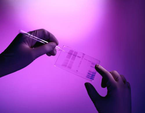 Picture 1 of Launch a large-scale organ scanning project