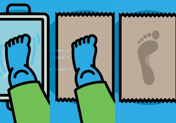 Picture 4 of Learn about flat foot syndrome - the cause and treatment