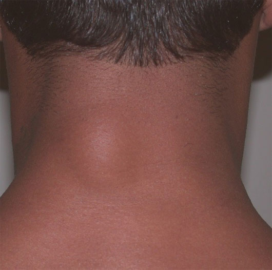 Picture 4 of Learn about 'horror' things in the human body