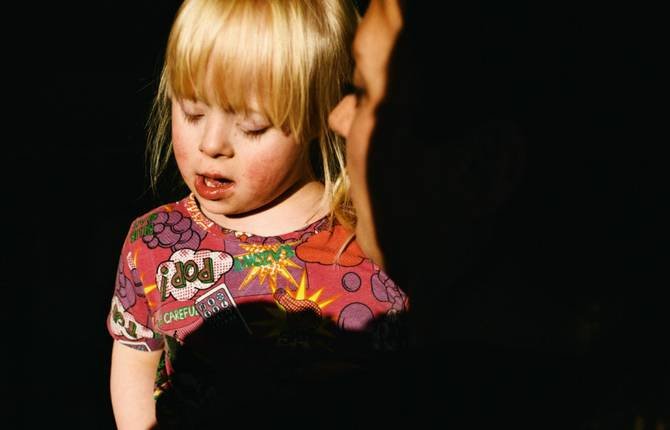 Picture 1 of Learn Down syndrome and the truth you should know