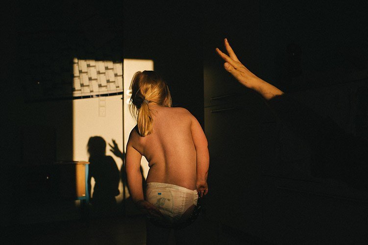 Picture 4 of Learn Down syndrome and the truth you should know