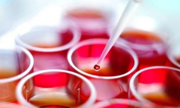Picture 3 of Learn some dangerous blood diseases
