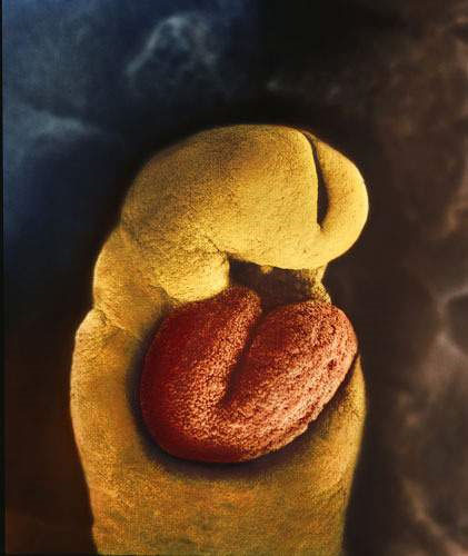 Picture 6 of Learn the process of conception in humans through images