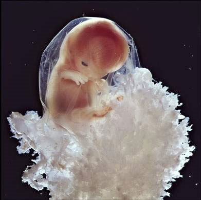 Picture 8 of Learn the process of conception in humans through images