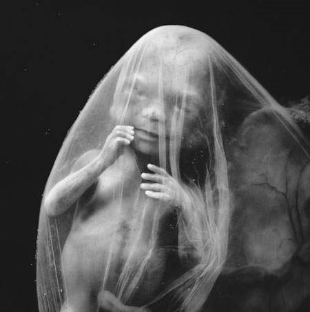 Picture 9 of Learn the process of conception in humans through images