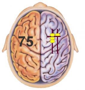 Picture 2 of Learn the super mental math method of 5th graders that makes adults cumulatively
