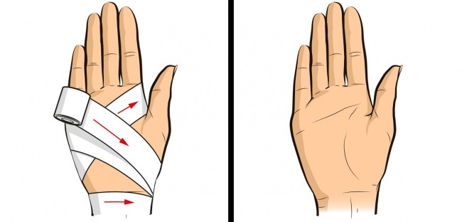 Picture 10 of Life skills save your life in unexpected situations