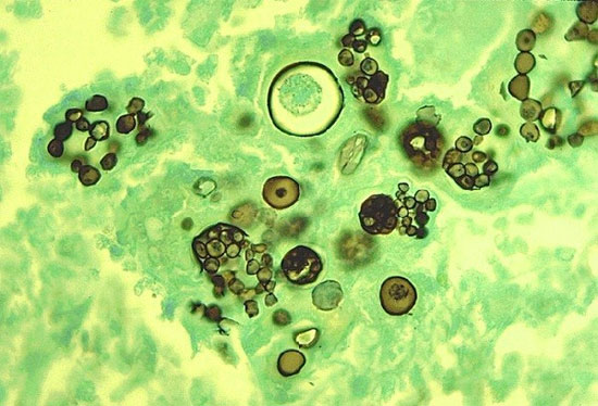 Picture 5 of Little known 'botanical' pitfalls