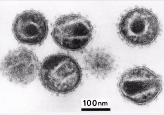Picture 1 of Little-known facts about the virus: Where do they come from, how do they spread and cause illness?