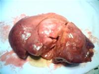 Picture 2 of Liver cancer: preventable!