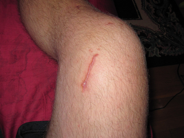 Picture 3 of Logan's ability to restore his wounds is real, but not as dramatic as in the movie