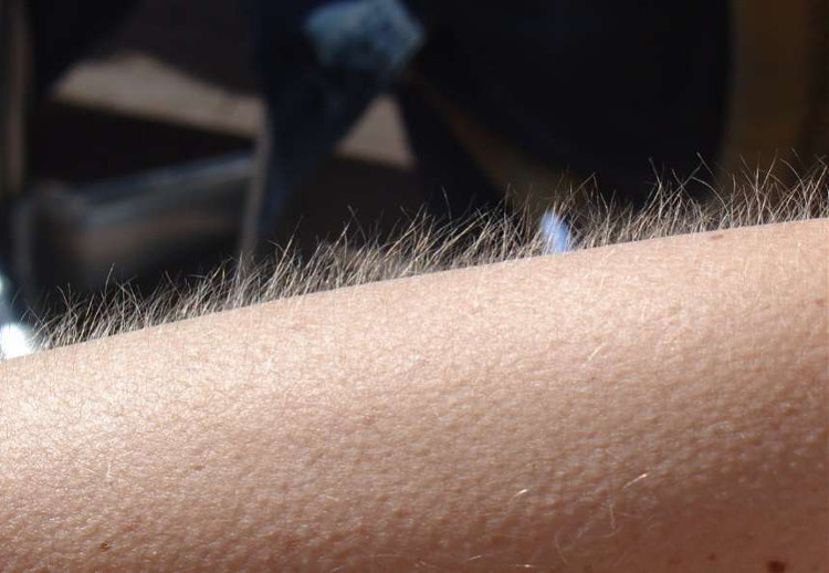 Picture 2 of Look for the reason why some people get goose bumps when listening to music, others don't