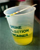 Picture 2 of Look for urine to guess the disease