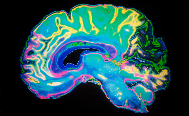 Picture 2 of Lost is the first sign of Alzheimer's