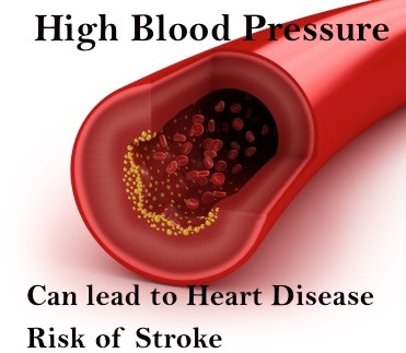 Picture 4 of Lower your blood pressure with a diet rich in potassium