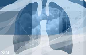 Picture 1 of Lung diseases kill women more than breast cancer