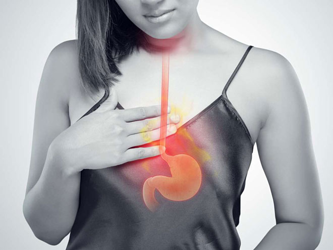 Picture 2 of Make lifestyle changes to combat gastroesophageal reflux disease