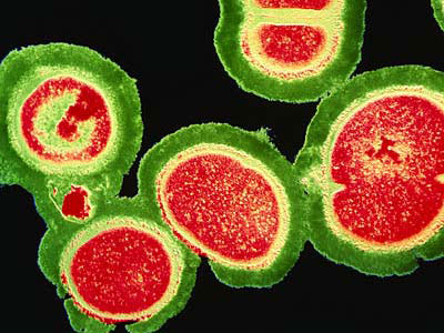 Picture 2 of Manuka honey can control MRSA virus