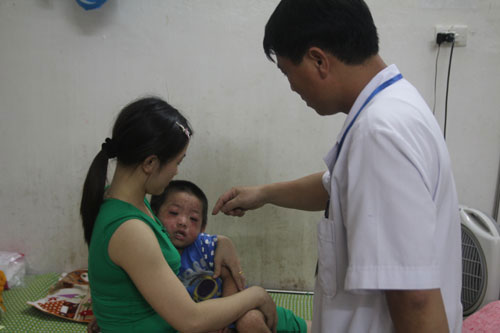 Picture 1 of Many cases of measles happen strange