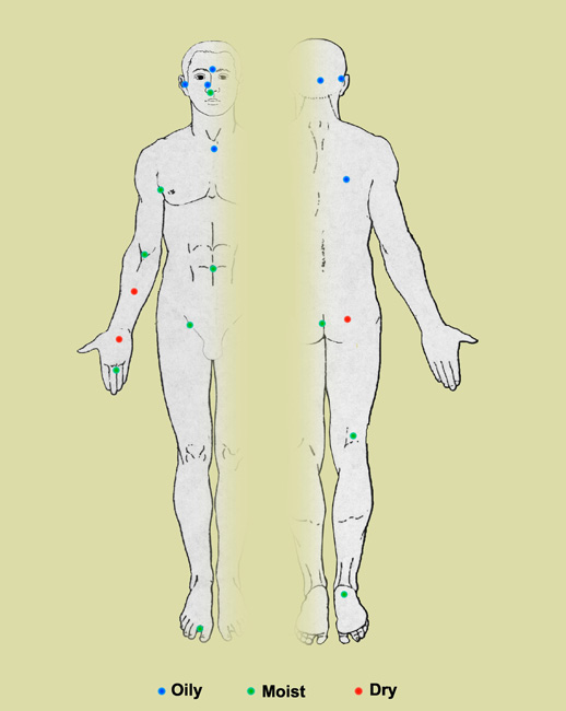 Picture 1 of Many types of bacteria are found on the skin