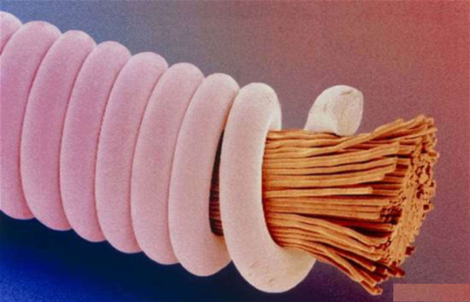 Picture 10 of Marvel at 35 familiar images that become incredibly bizarre under a microscope