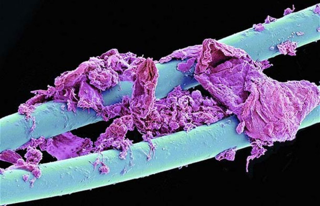 Picture 12 of Marvel at 35 familiar images that become incredibly bizarre under a microscope