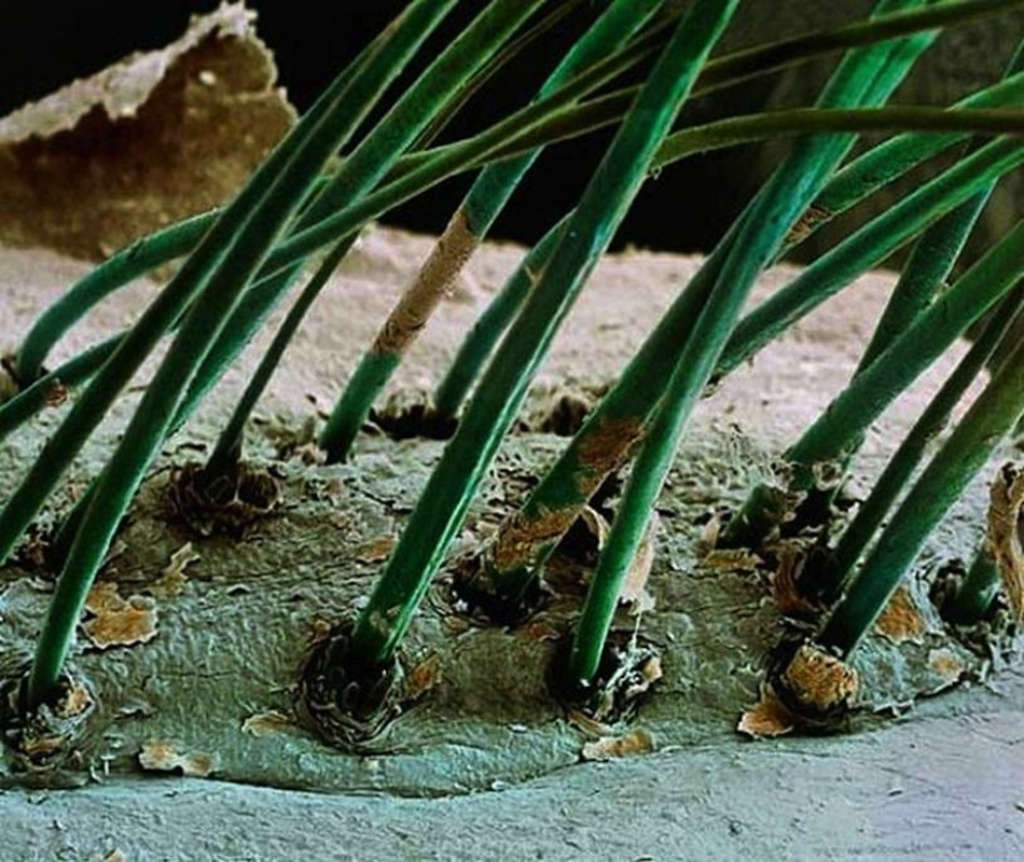 Picture 13 of Marvel at 35 familiar images that become incredibly bizarre under a microscope