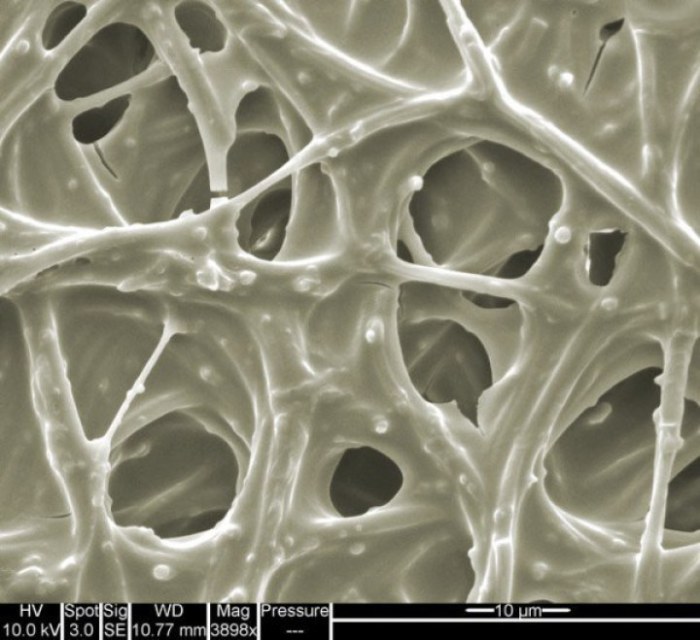 Picture 14 of Marvel at 35 familiar images that become incredibly bizarre under a microscope
