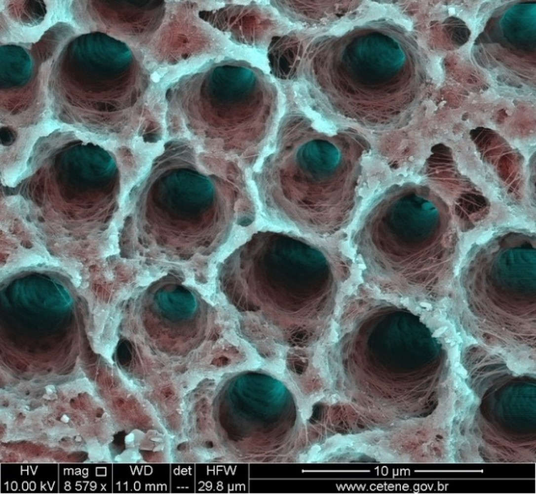 Picture 16 of Marvel at 35 familiar images that become incredibly bizarre under a microscope