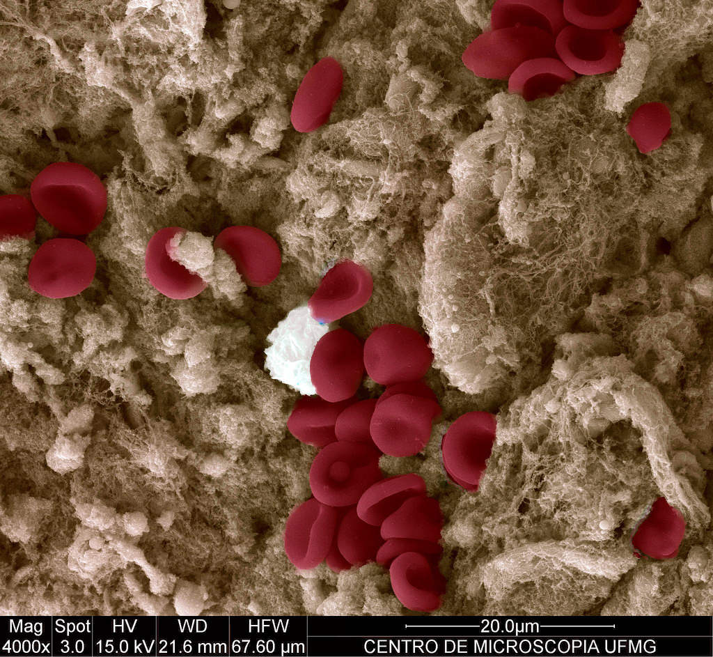 Picture 17 of Marvel at 35 familiar images that become incredibly bizarre under a microscope