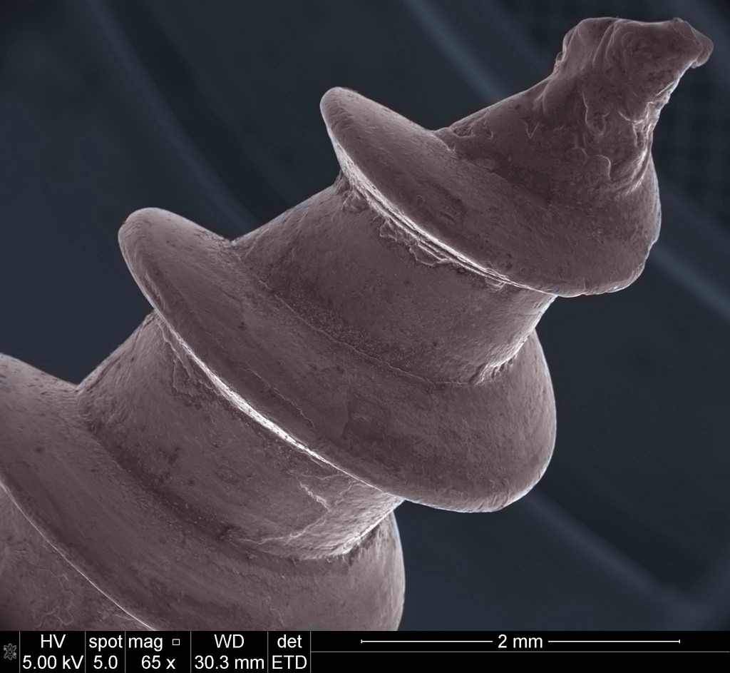 Picture 19 of Marvel at 35 familiar images that become incredibly bizarre under a microscope