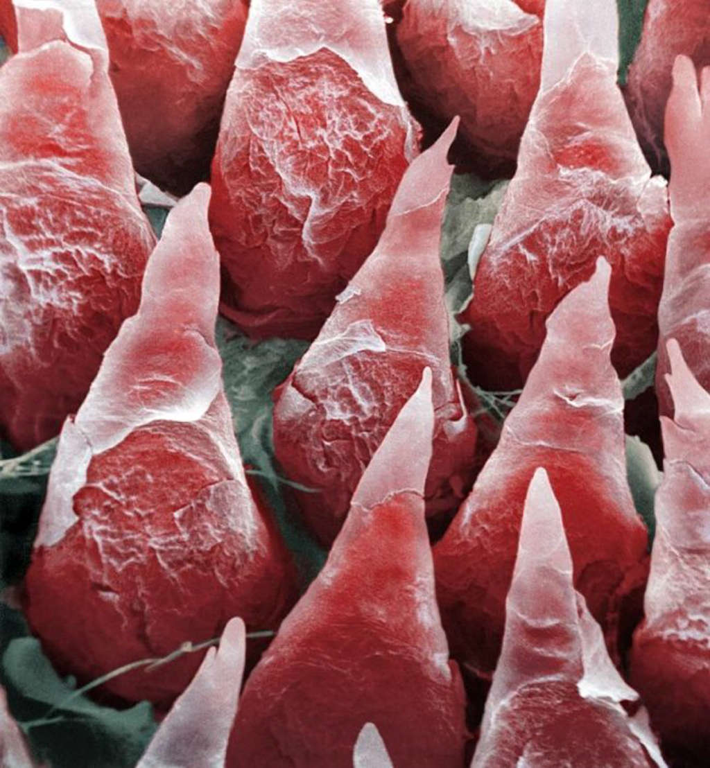 Picture 20 of Marvel at 35 familiar images that become incredibly bizarre under a microscope