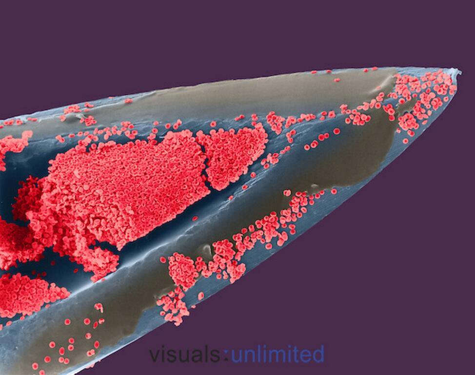 Picture 22 of Marvel at 35 familiar images that become incredibly bizarre under a microscope
