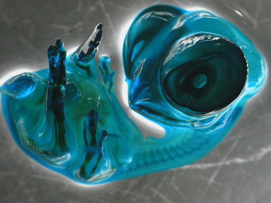 Picture 25 of Marvel at 35 familiar images that become incredibly bizarre under a microscope